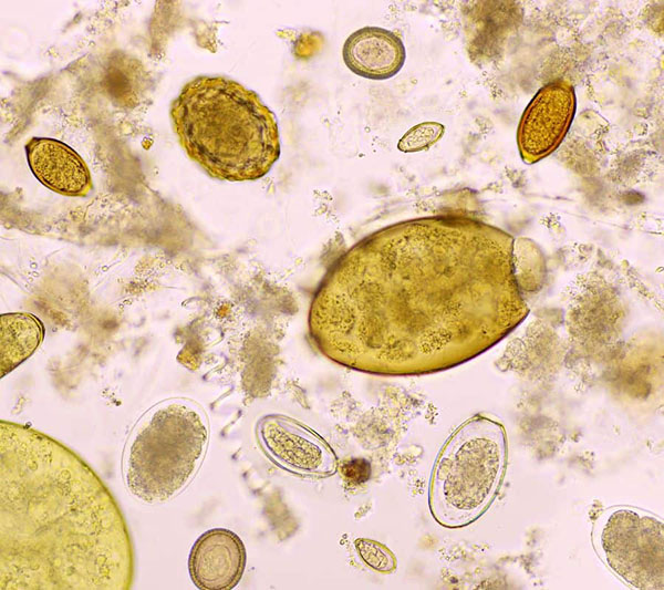 CHMP对伊维菌素 / 阿苯达唑用于治疗由多种蠕虫寄生虫引起的感染给出积极科学意见